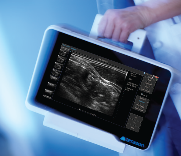 Grab-n-Go Portability