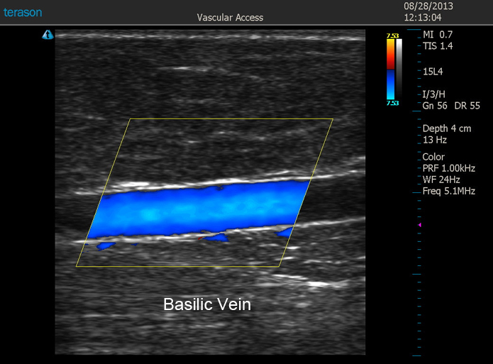 Vascular Access Imaging