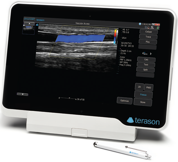 Terason uSmart 3200T Tablet Ultrasound Machine