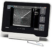 Terason uSmart 3200T ultrasound tablet