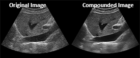 advanced ultrasound imaging optimization